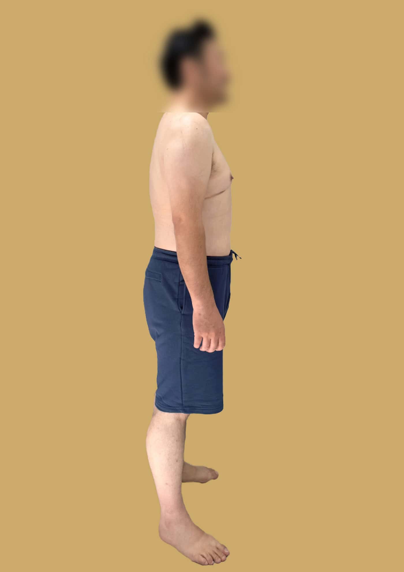 arii_03_after-rr_pc@2x